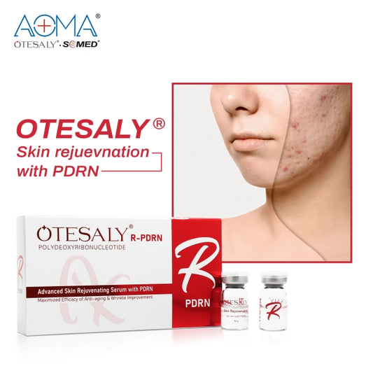OTESALY® Advanced Skin Rejuvenating Serum with PDRN - Medicina Estética Anti-Aging con Ácido Hialurónico- biofillers rejuvenecedor de piel relleno facial